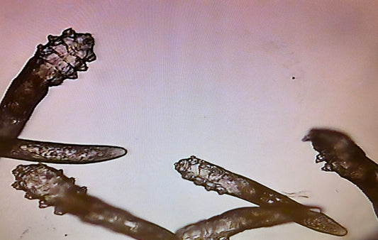 Talipunkit hiuspohjassa - voivatko ne liittyä hiuspohjan oireisiin?
